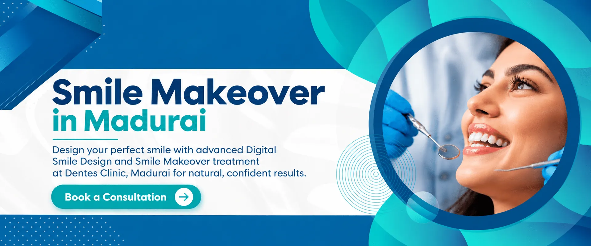 Smile Makeover in Madurai