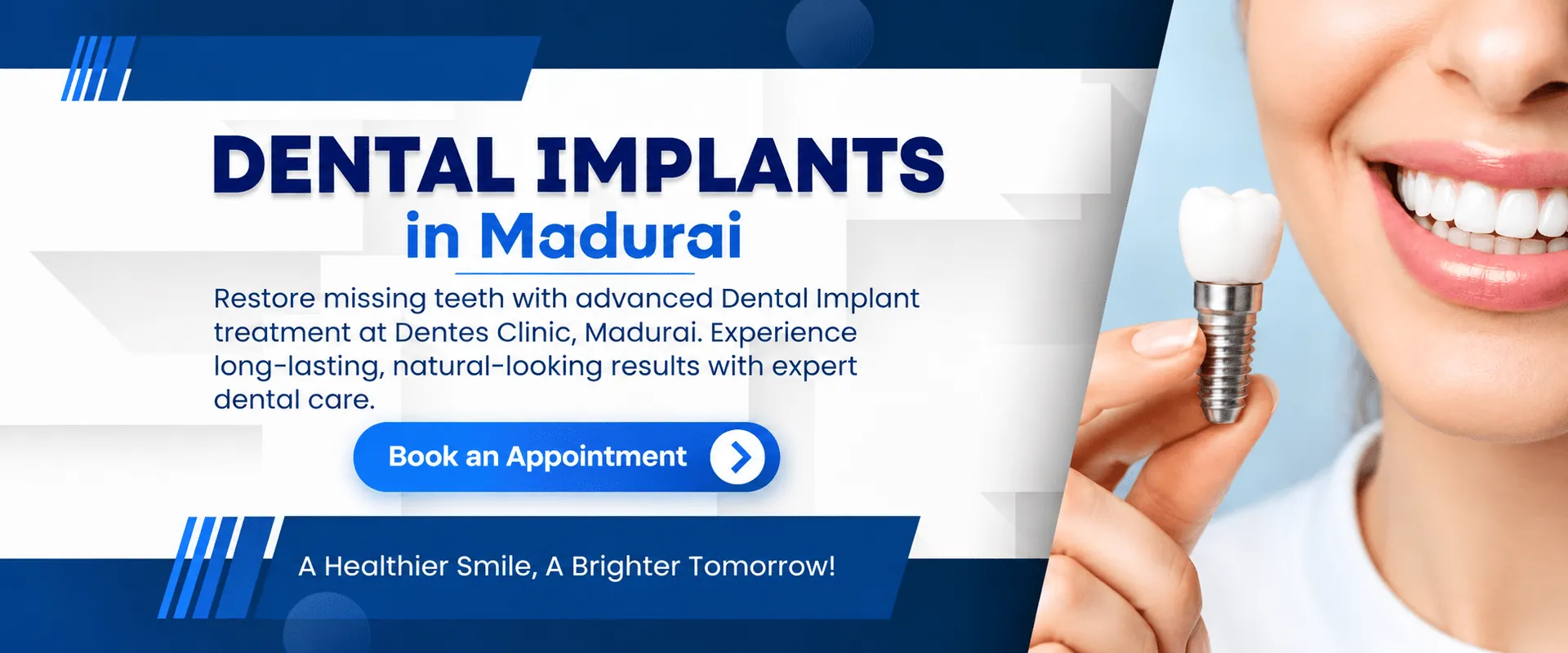 Dental Implants in Madurai