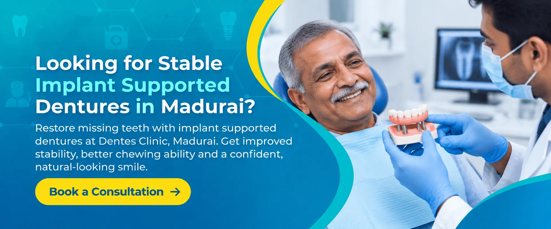 Implant Supported Dentures in Madurai