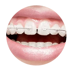Best Dentist in Madurai - Dentes Clinic