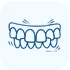 Dental Aligners in Madurai - Dentes Clinic