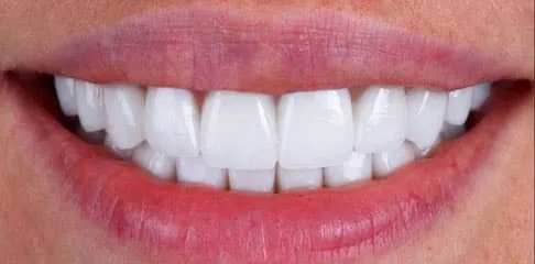 Best Dental Clinic in Madurai - Dentes Clinic