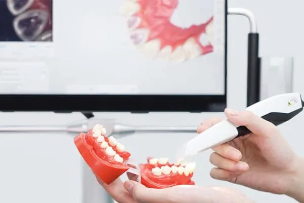 Dentures in Madurai - Dentes Clinic