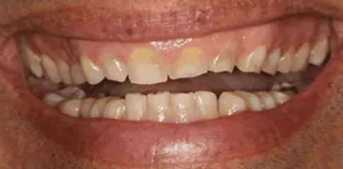 Best Dental Clinic in Madurai - Dentes Clinic