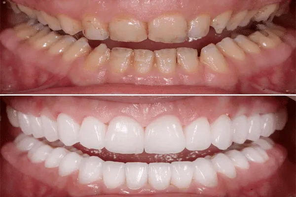 Trusted dental care and treatment in Madurai