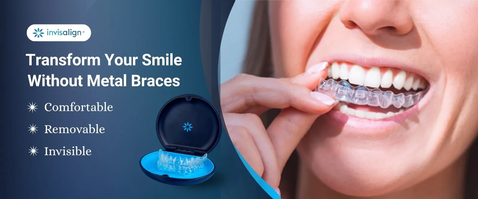 Flexible Dentures in Madurai