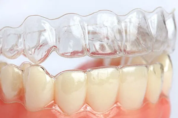 Dental Clinic in Madurai - Dentes Clinic