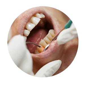 Best Dental Clinic in Madurai - Dentes Clinic