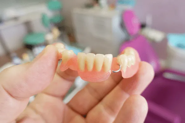 Remove Gaps in Teeth in Madurai - Dentes Clinic
