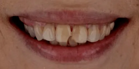 Dental Clinic in Madurai - Dentes Clinic