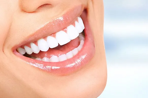 Digital Smile Design in Madurai - Dentes Clinic