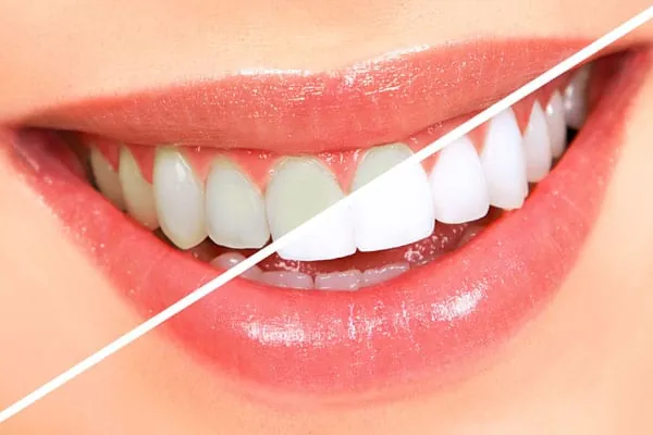 Best Dentist in Madurai - Dentes Clinic