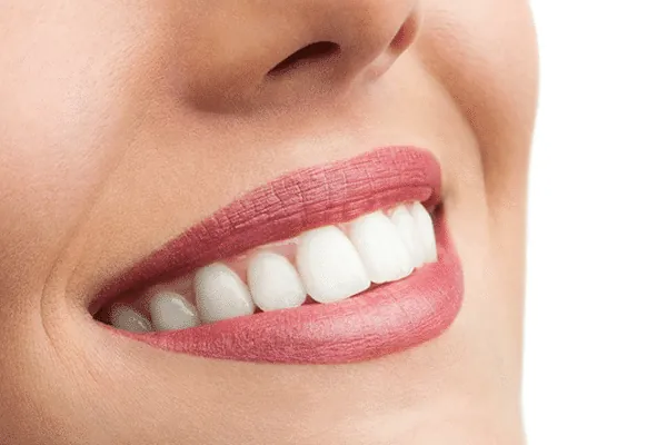 Cosmetic dental treatment for an enhanced smile